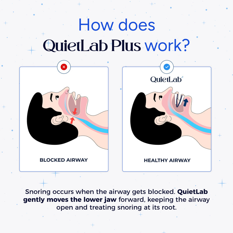 Premium QuietLab Plus Adjustable Anti-Snoring Mouthpiece